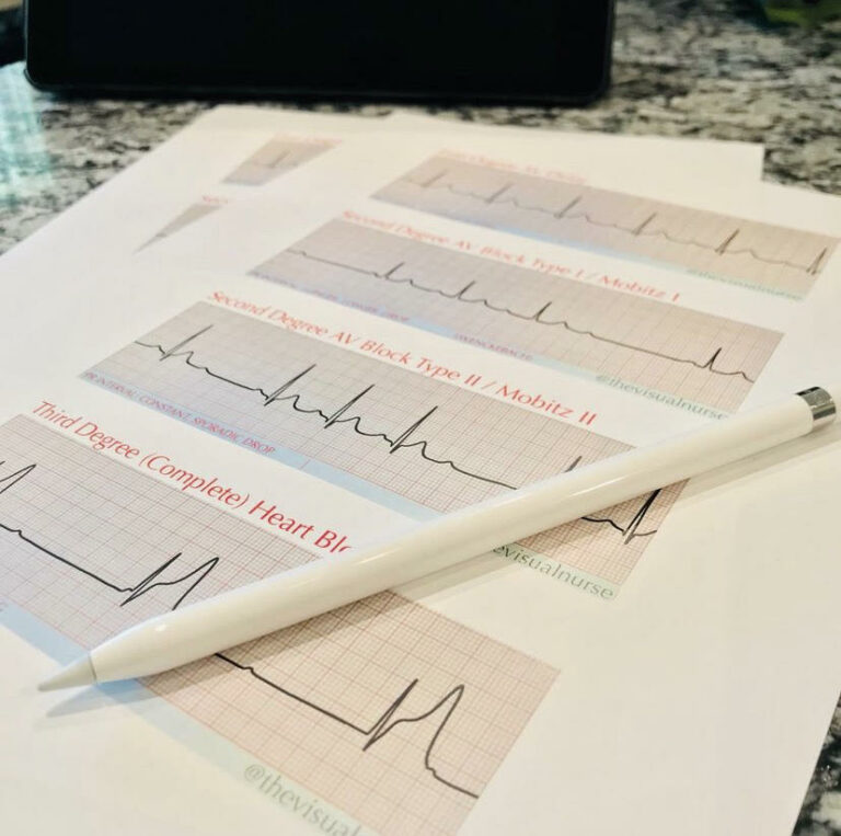 ECG Basics: Understanding the Essentials