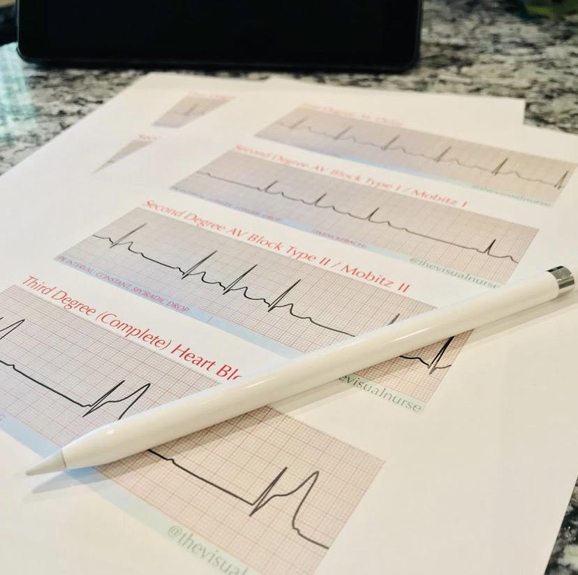 ECG Basics: Understanding the Essentials